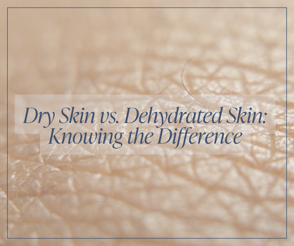 Dehydrated Skin vs. Dry Skin: How to Identify and Fix Both
