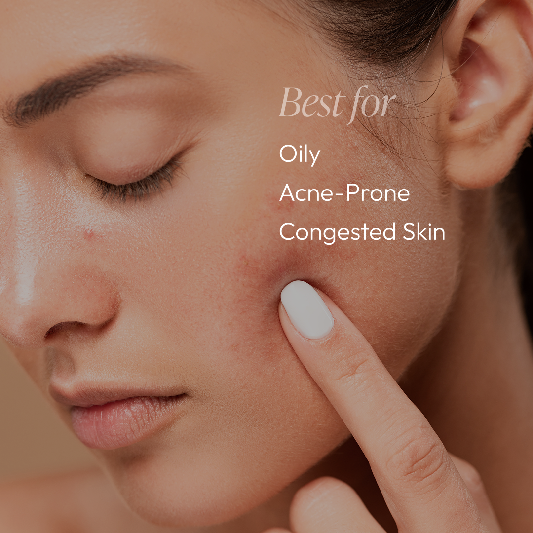 Acne Essentials Regimen Kit