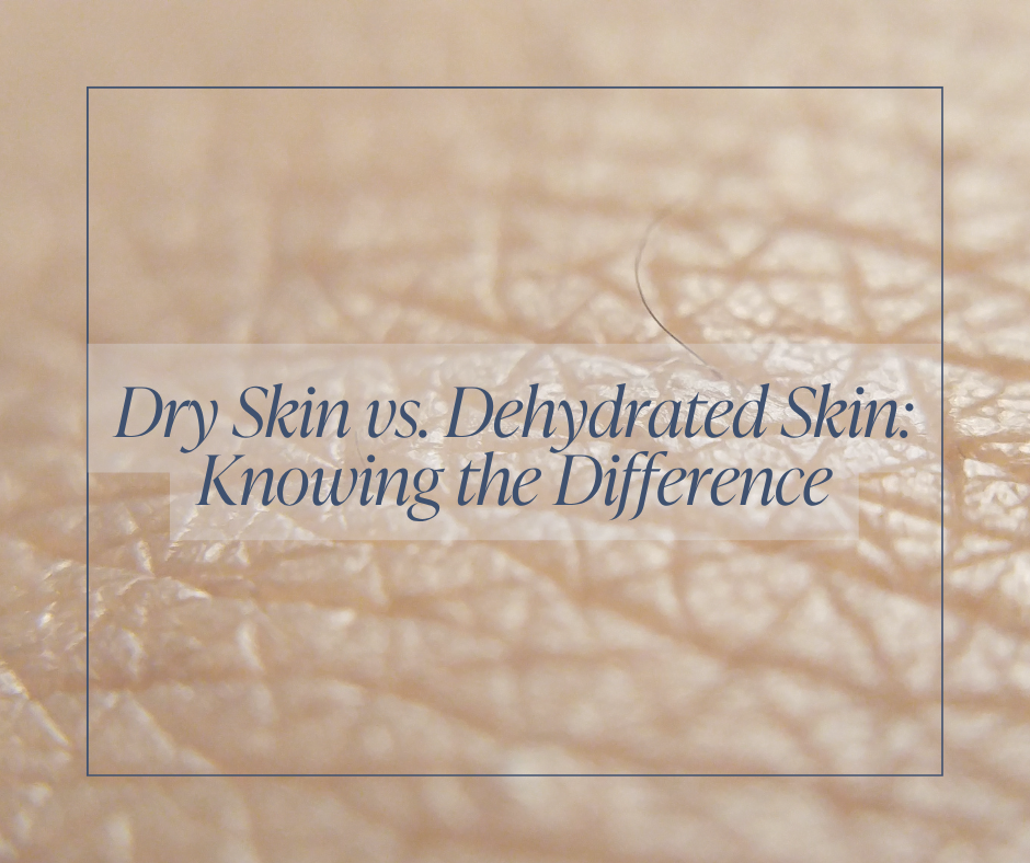 Dehydrated Skin vs. Dry Skin: How to Identify and Fix Both