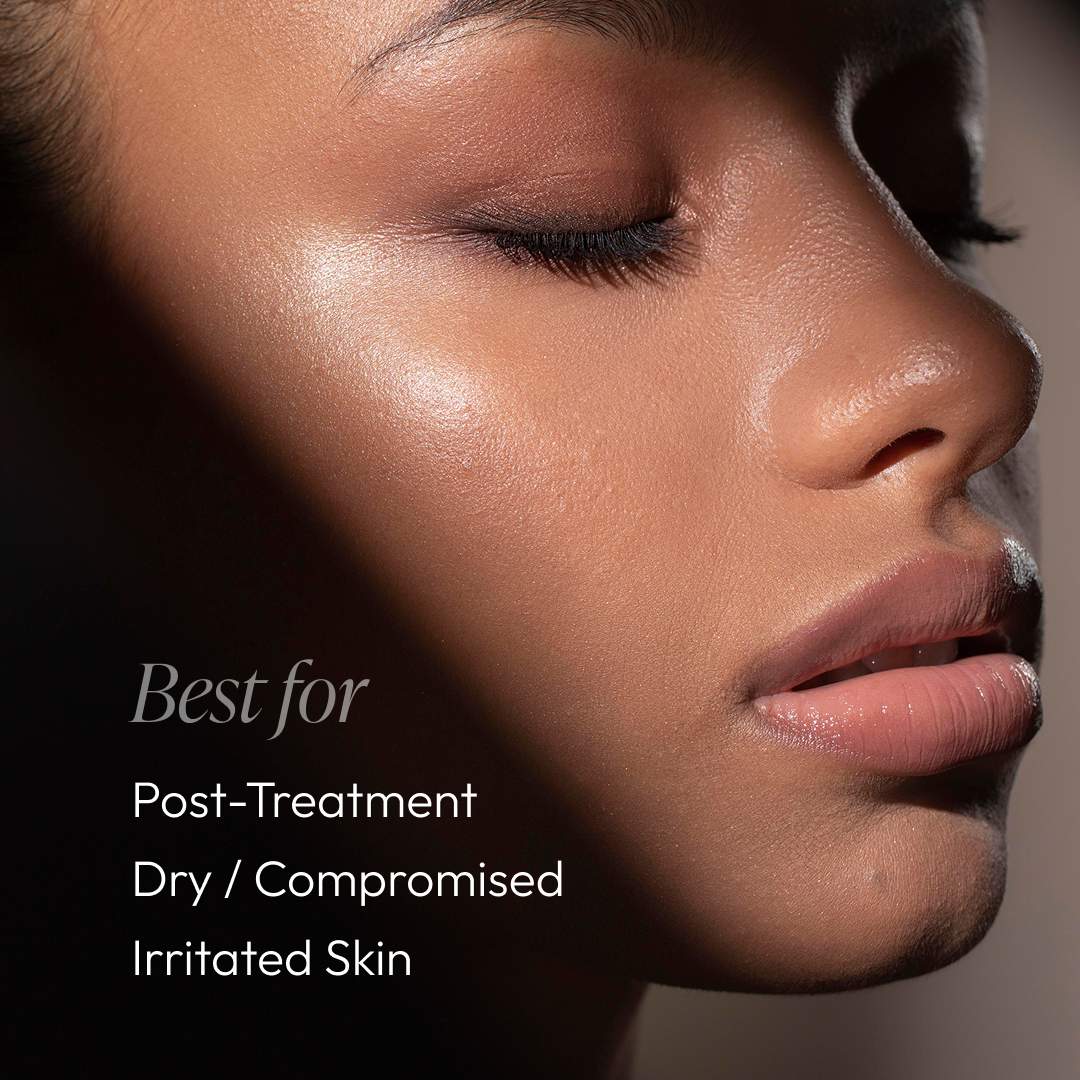 Post Treatment Balm (formerly Post Peel Balm)