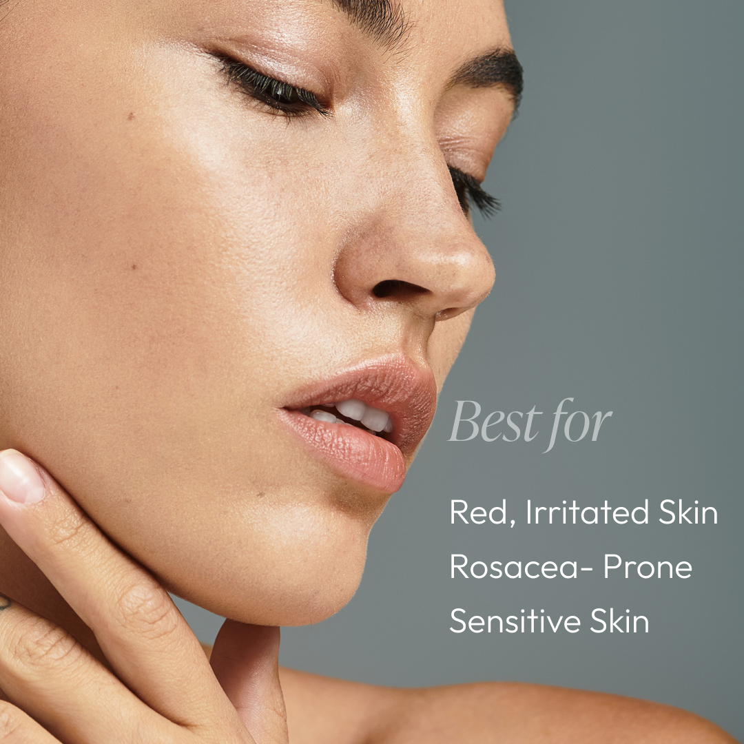 Rose-Ease Relief Cream