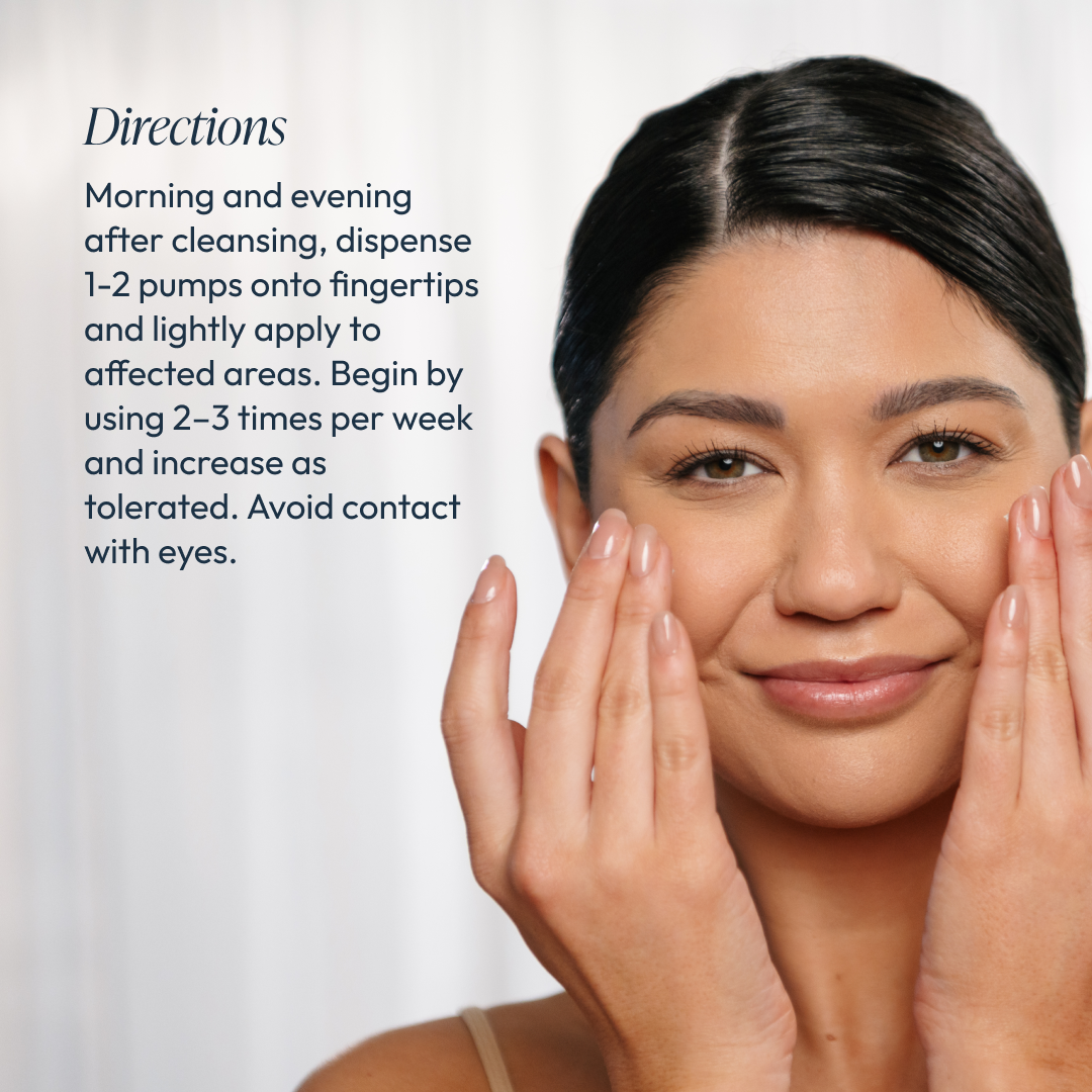 Rose-Ease Relief Cream