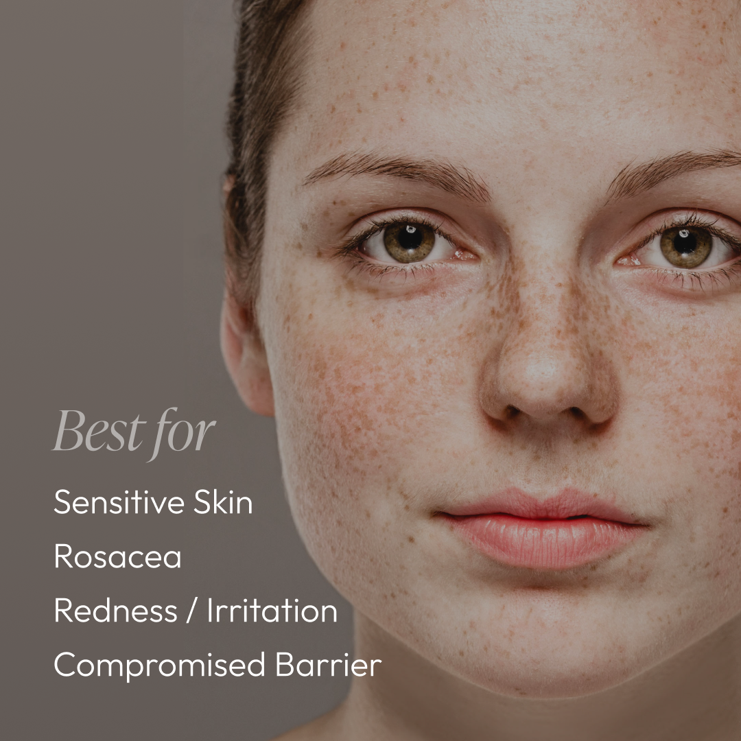 Sensitive Essentials Regimen Kit